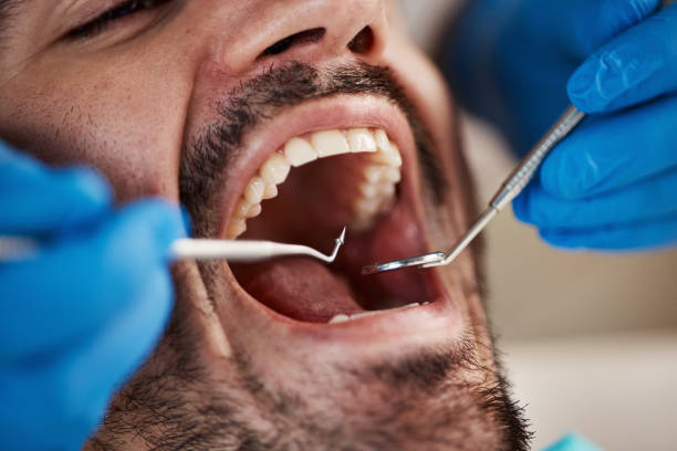 Best Dentist for Tooth Abscess  in Acworth, GA