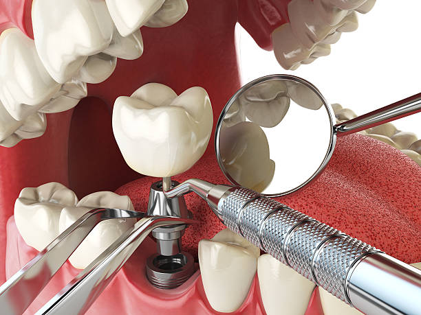 24-Hour Dental Clinic Near Me in GA